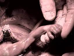 time magazine prenatal surgery